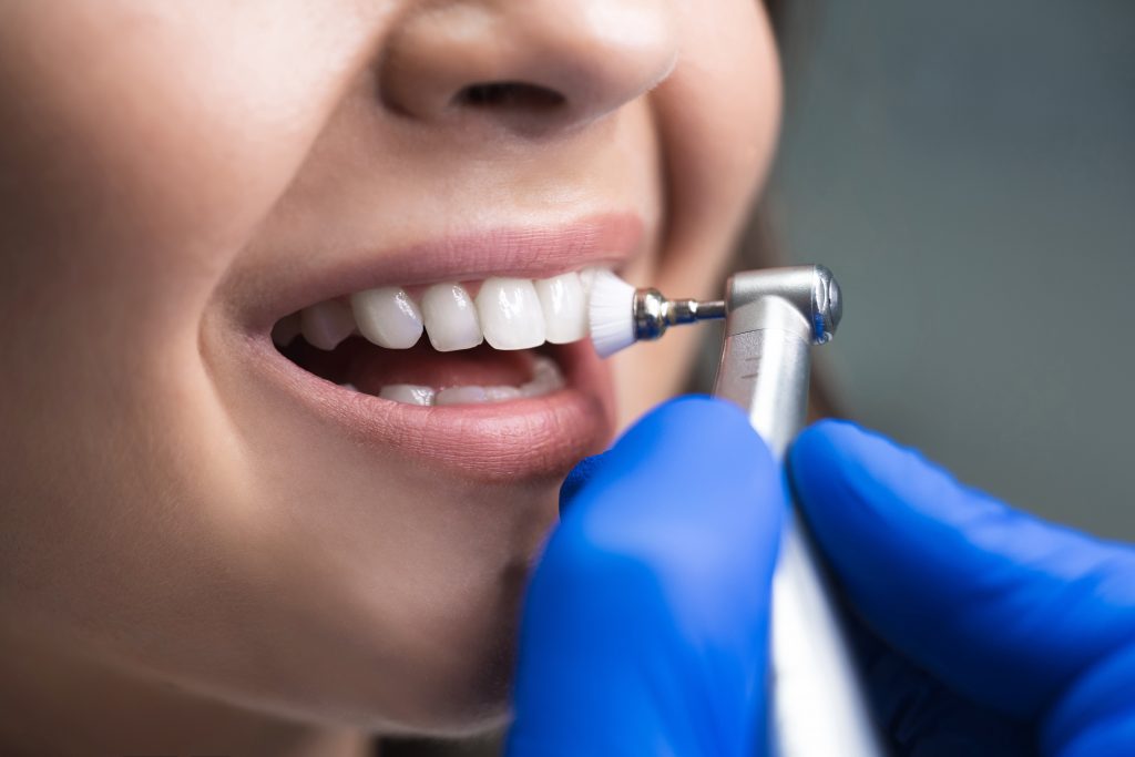 Close-up of a woman's teeth being cleaned by a dental tool during a professional dental cleaning