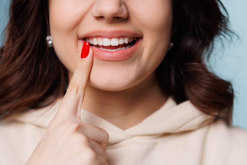 A close-up photo of a woman's teeth