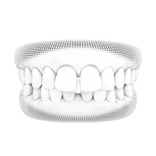 3D wireframe model of gapped teeth