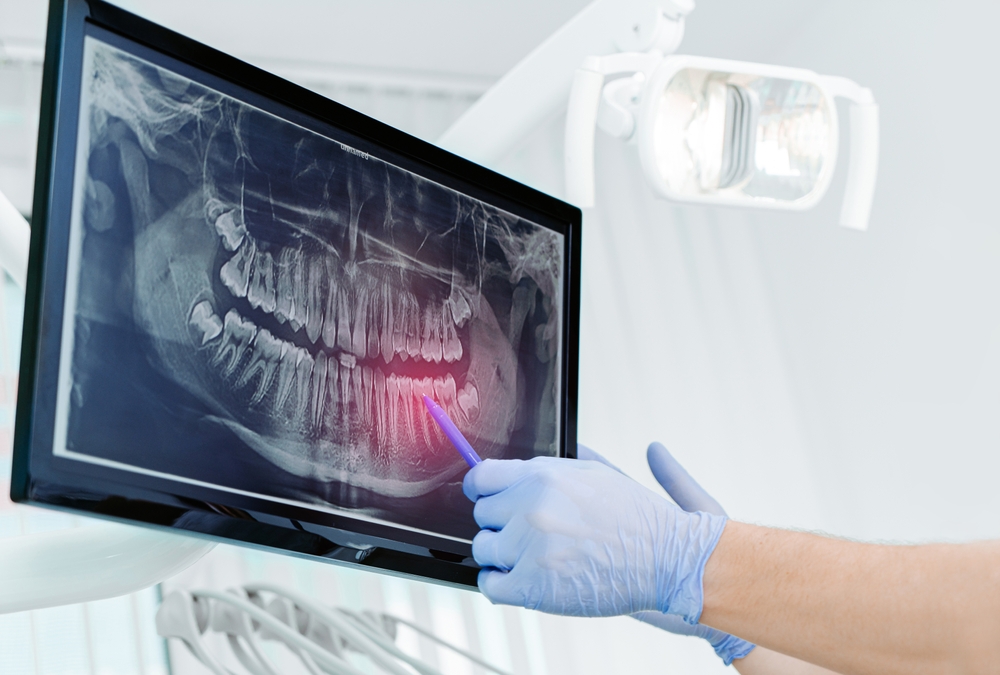 dentist shows the teeth on x-ray on digital screen