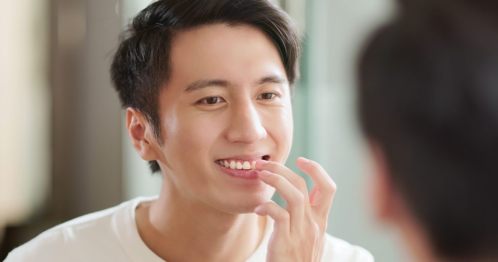 a man looking at his teeth