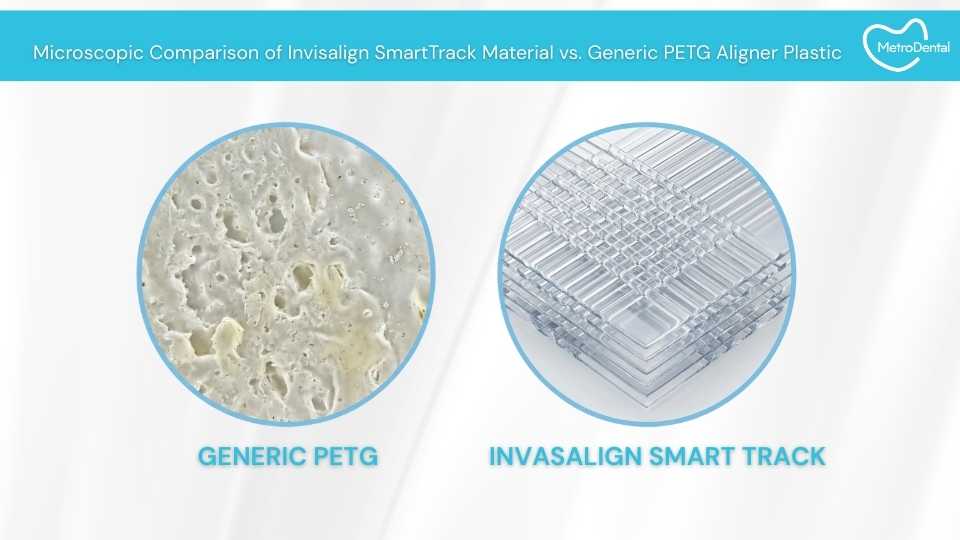 cheapest invisalign in the philippines